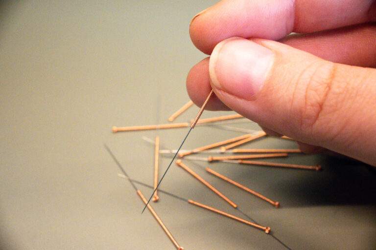 Annatomie acupunctuur