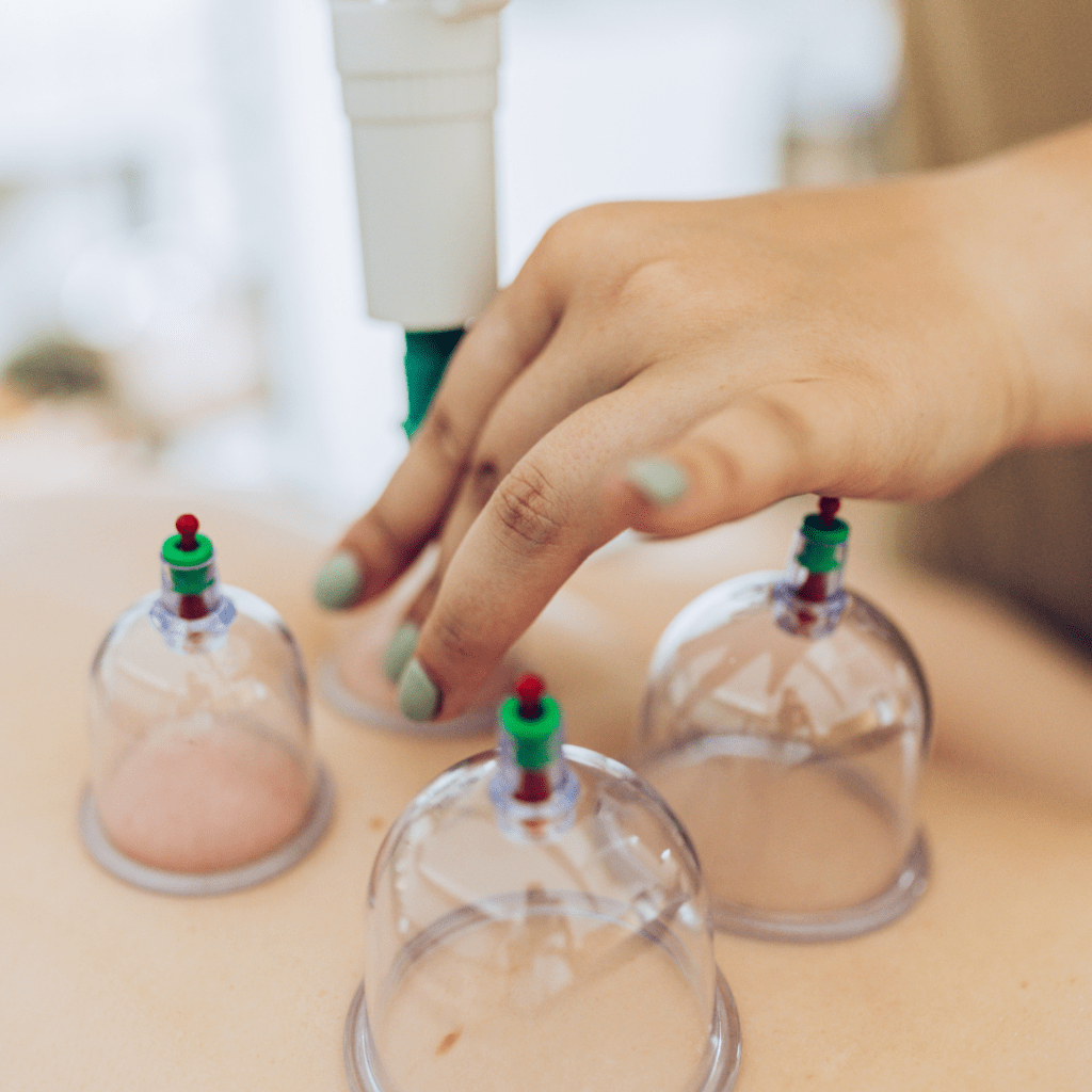 Annatomie, Cupping