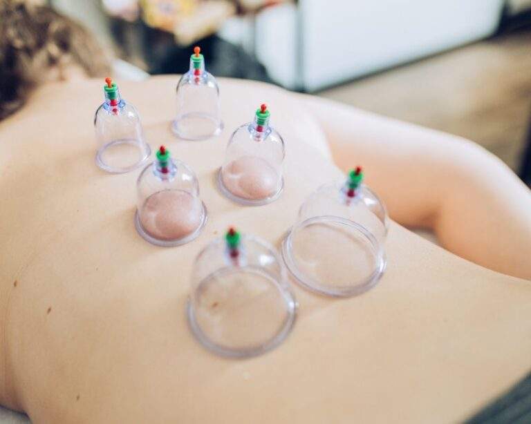 cupping behandeling