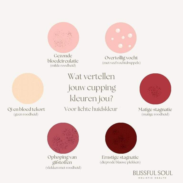 cupping plekken